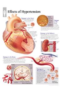Effects of Hypertension Chart