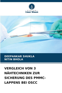 Vergleich Von 3 Nähtechniken Zur Sicherung Des Pmmc-Lappens Bei Oscc