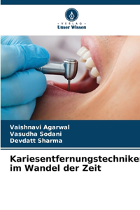 Kariesentfernungstechniken im Wandel der Zeit