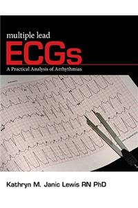 Multiple Lead ECGs