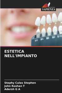 Estetica Nell'impianto