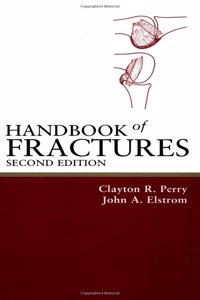 Handbook of Fractures, 2/e