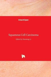 Squamous Cell Carcinoma