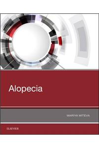 Alopecia