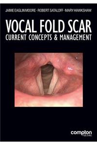 Vocal Fold Scar