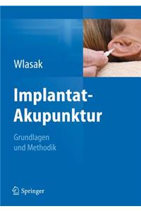 Implantat-Akupunktur