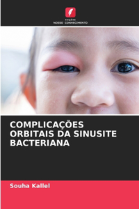 Complicações Orbitais Da Sinusite Bacteriana