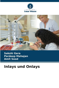 Inlays und Onlays