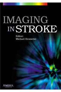 Imaging in Stroke