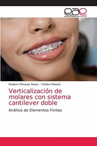 Verticalización de molares con sistema cantilever doble