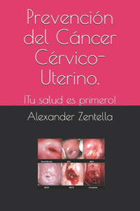 Prevención del Cáncer Cérvico-Uterino.