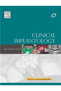 Clinical Implantology