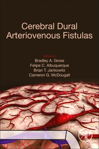 Cerebral Dural Arteriovenous Fistulas