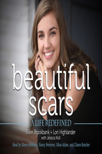 Beautiful Scars