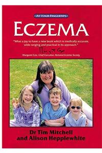 Eczema