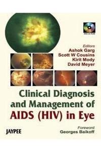 Clinical Diagnosis and Management of AIDS (HIV) in Eye with CD-ROM