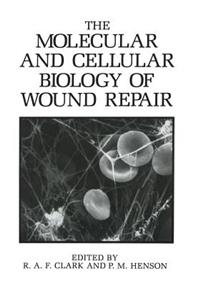 The Molecular and Cellular Biology of Wound Repair