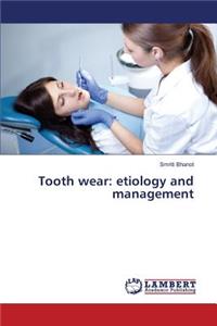 Tooth wear