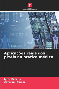 Aplicações reais dos pixéis na prática médica