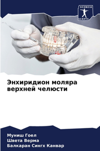 Энхиридион моляра верхней челюсти