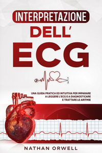 Interpretazione dell'ECG