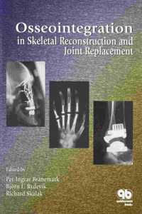 Osseo Integration in Skeletal Reconstruction and Joint Replacement