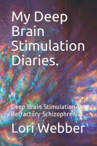 My Deep Brain Stimulation Diaries.