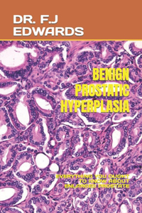 Benign Prostatic Hyperplasia