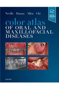 Color Atlas of Oral and Maxillofacial Diseases