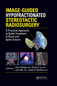 Image-Guided Hypofractionated Stereotactic Radiosurgery