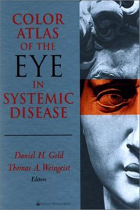 Color Atlas of the Eye in Systemic Disease