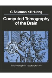 Computed Tomography of the Brain: Atlas of Normal Anatomy