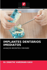 Implantes Dentários Imediatos