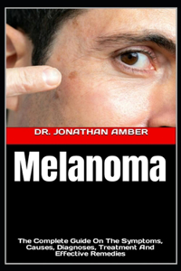 Melanoma