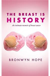 Breast is History