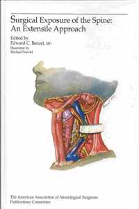 Surgical Exposure of the Spine: An Extensile Approach