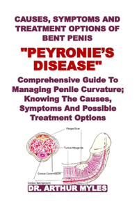 Causes, Symptoms and Treatment Options of Bent Penis 