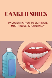 Canker Sores