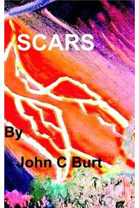 Scars