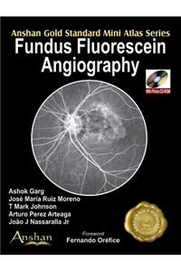 Mini Atlas of Fundus Fluorescein Angiography
