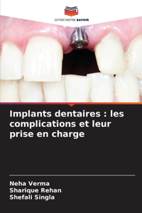 Implants dentaires