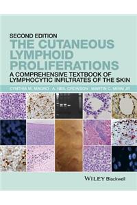 Cutaneous Lymphoid Proliferations