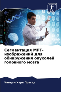 Сегментация МРТ-изображений для обнаруже