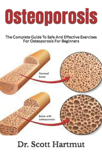 Osteoporosis