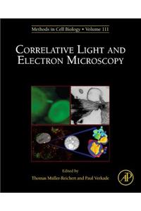 Correlative Light and Electron Microscopy