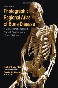 Photographic Regional Atlas of Bone Disease: A Guide to Pathologic and Normal Variation in the Human Skeleton