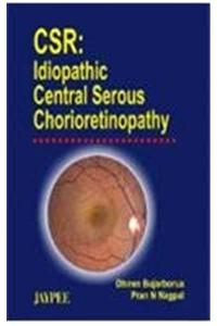 CSR Idiopathic Central Serous Chorioretinopathy