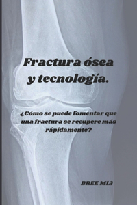 Fractura ósea y tecnología.
