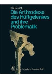 Die Arthrodese Des Hüftgelenkes Und Ihre Problematik