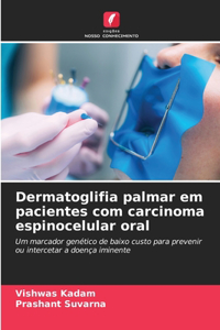 Dermatoglifia palmar em pacientes com carcinoma espinocelular oral